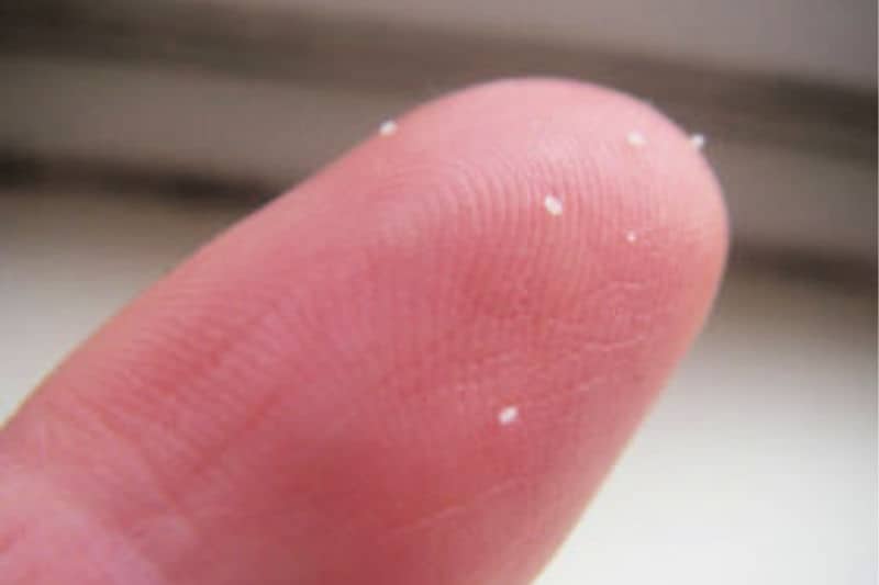 Huevos de pulgas en la yema del dedo